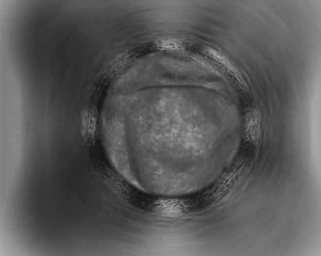 X0000096180417200802081503