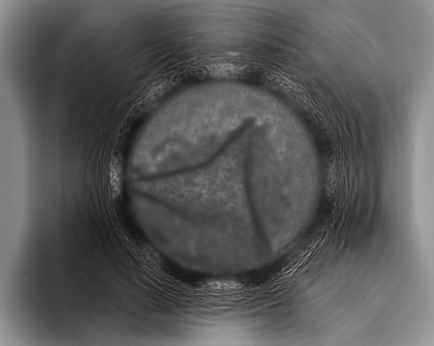 X0000096180644200802081500