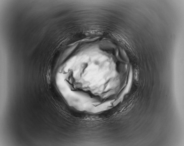 X0000096180915200802081456