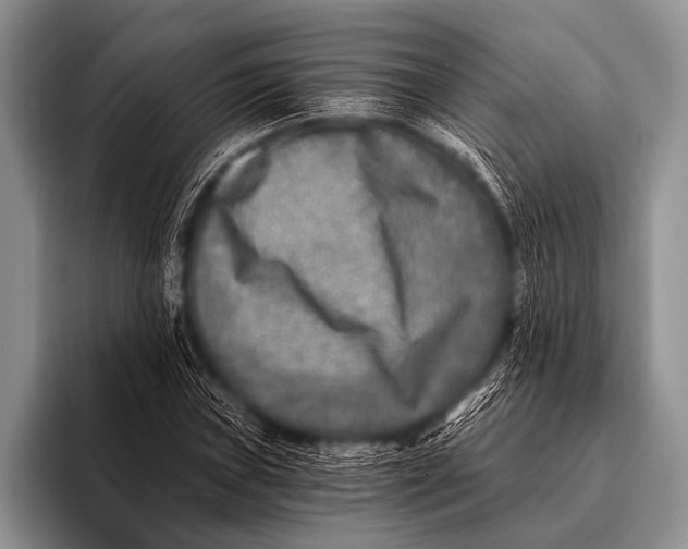 X0000096181019200802081455