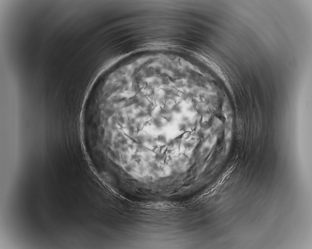 X0000096181045200802081455