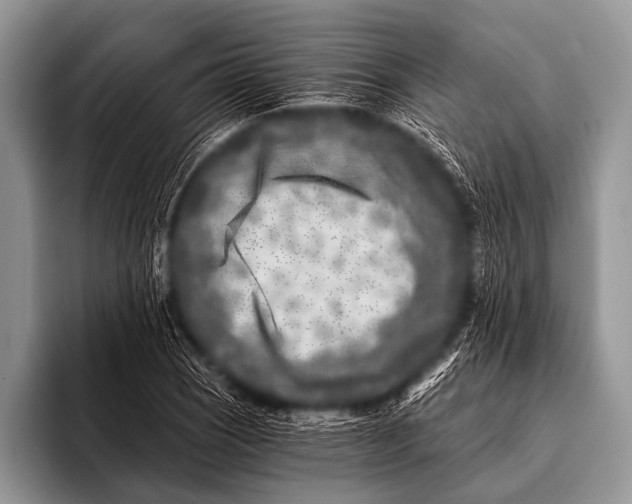 X0000096181121200802081454