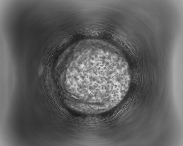 X0000096181297200802081451
