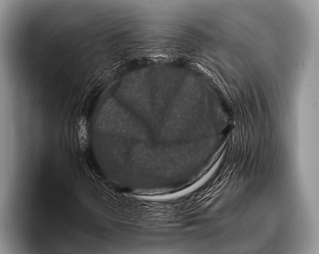 X0000096181298200802081451