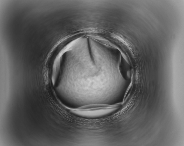 X0000096181310200802081451