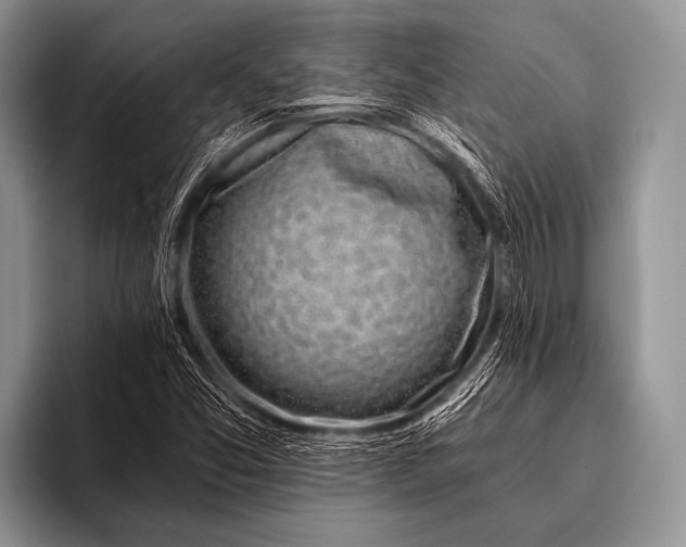 X0000096181357200802081451