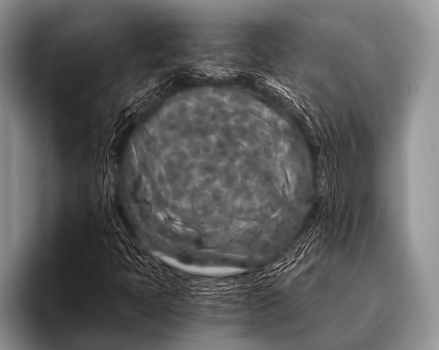 X0000096181397200802081450