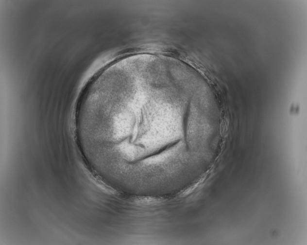X0000096180198200802151449