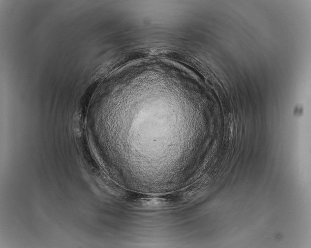 X0000096180316200802151447