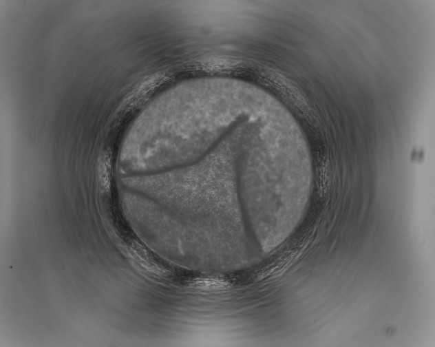 X0000096180644200802151442