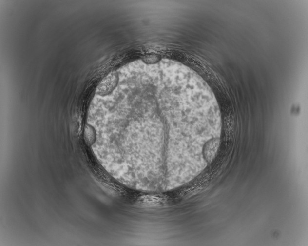 X0000096180703200802151441