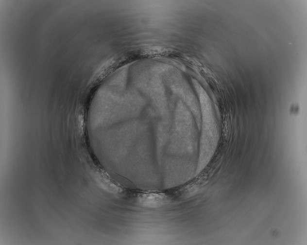 X0000096180716200802151441
