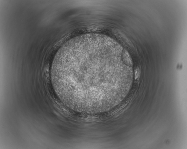 X0000096181011200802151436