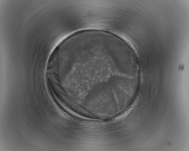 X0000096181077200802151436