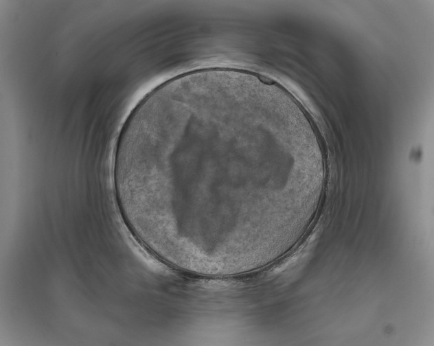 X0000096181246200802151434
