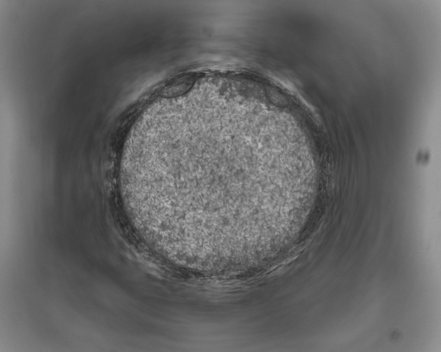 X0000096181399200802151430