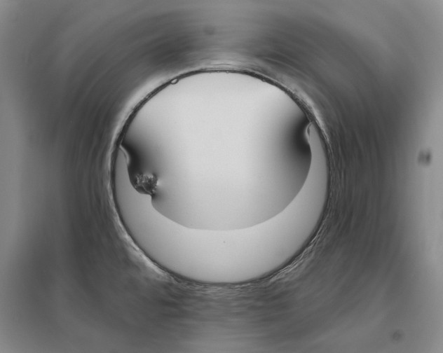 X0000096181480200802151430