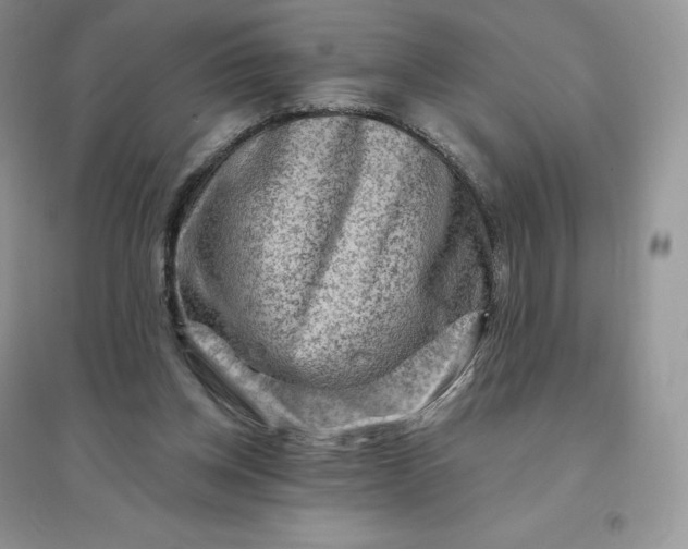 X0000096190158200802011415