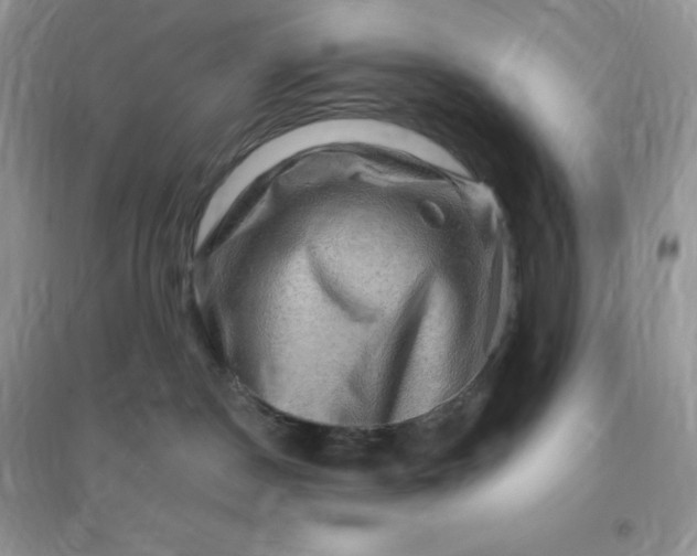 X0000096190190200802011415