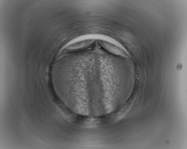 X0000096190319200802011413