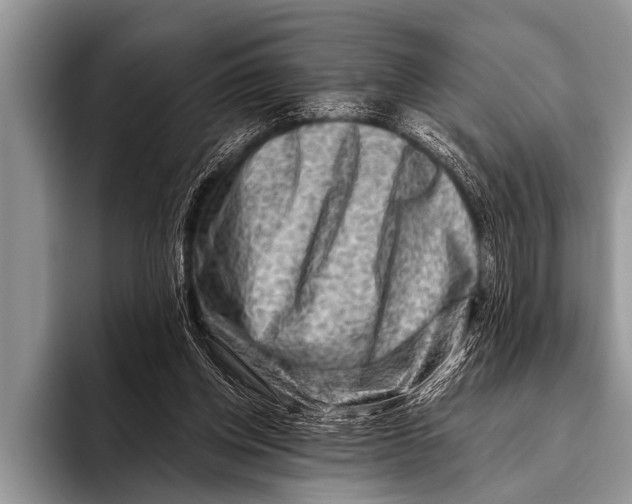 X0000096190158200802081527