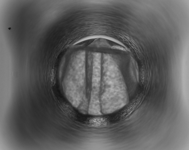 X0000096190759200802081520