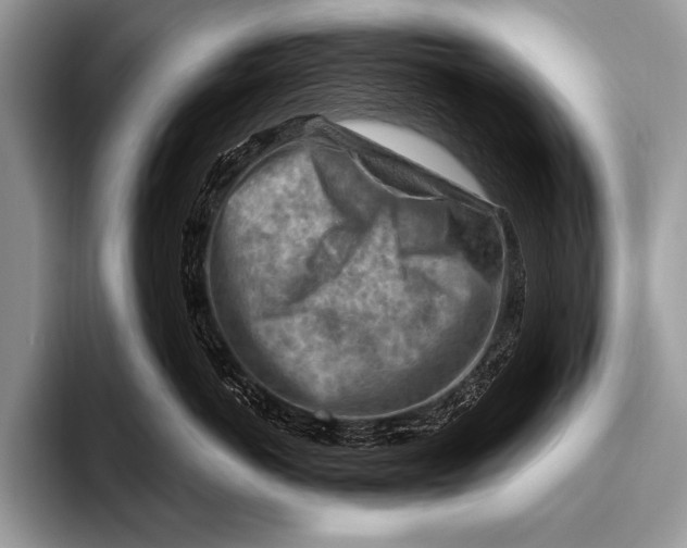 X0000096190766200802081520