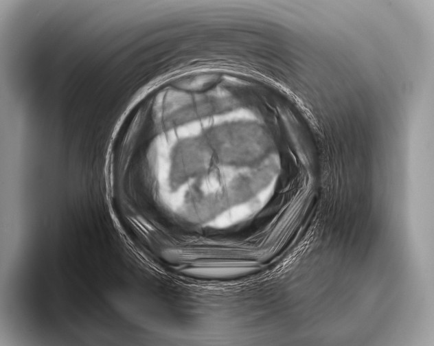 X0000096191522200802081509