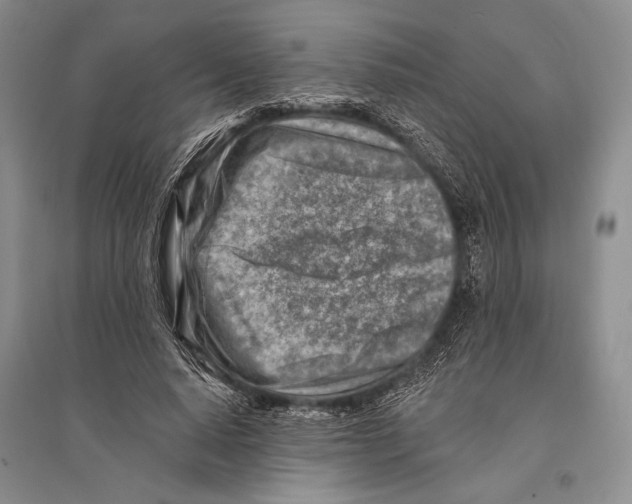 X0000096190640200802151504