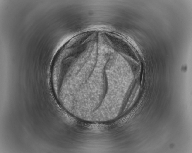 X0000096191277200802151455