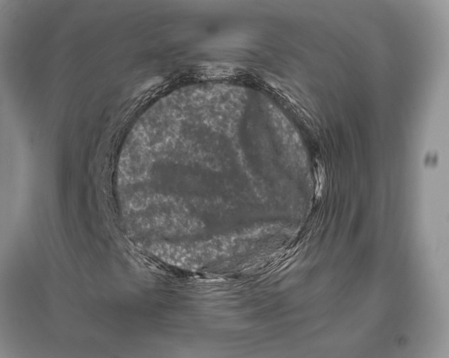 X0000096201441200802151515