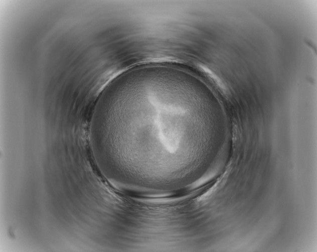 X0000096211361200801251025