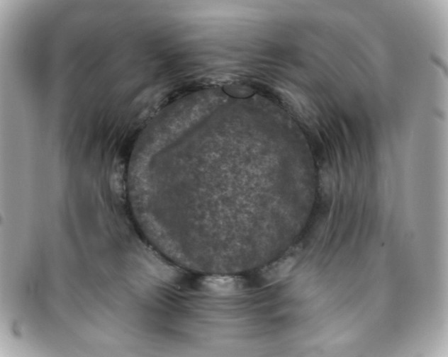 X0000096210181200802011329