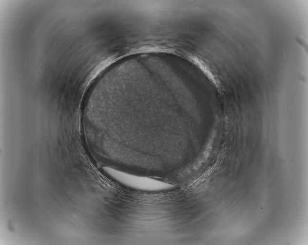 X0000096211173200802081454