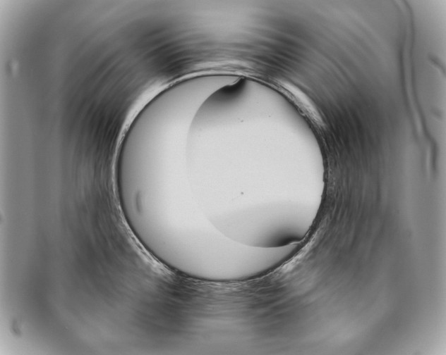 X0000096211196200802081454