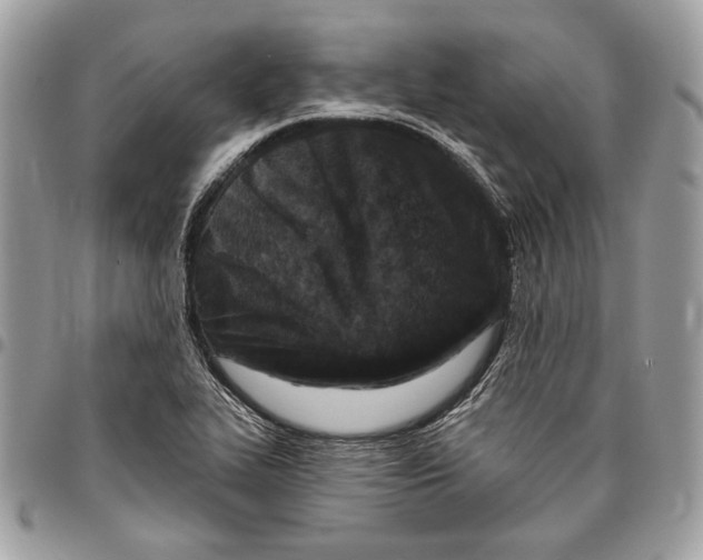 X0000096211319200802081452