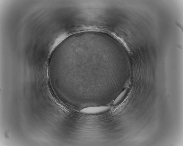 X0000096211365200802081452