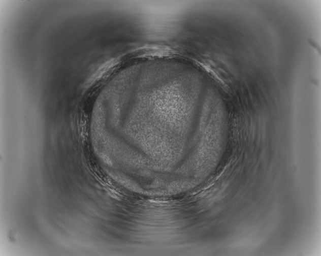 X0000096211399200802081450