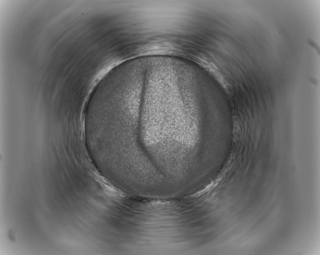 X0000096211419200802081451