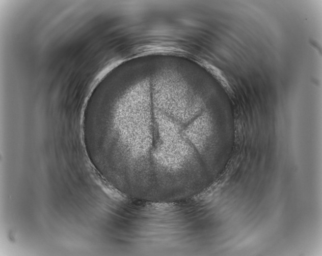 X0000096211427200802081451