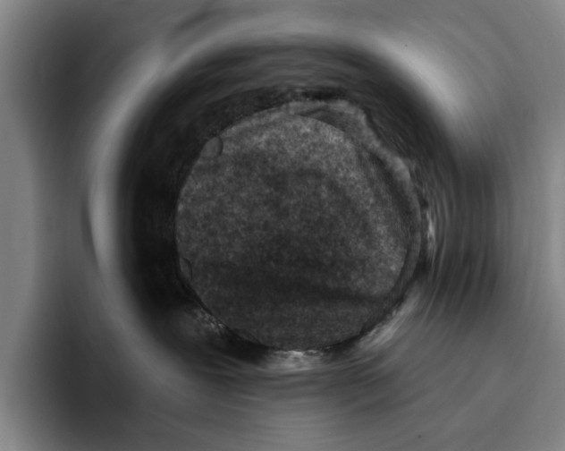 X0000096210239200802151508
