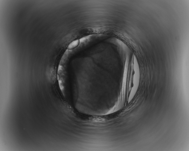 X0000096210471200802151505