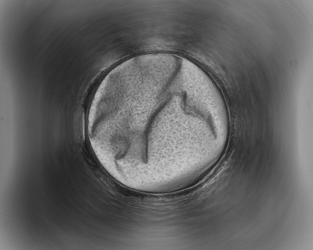 X0000096211219200802151455