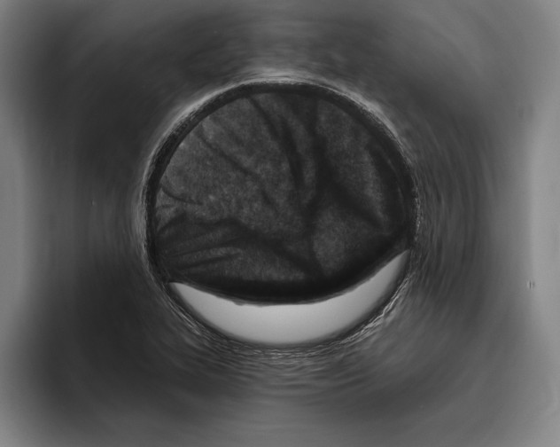 X0000096211319200802151454