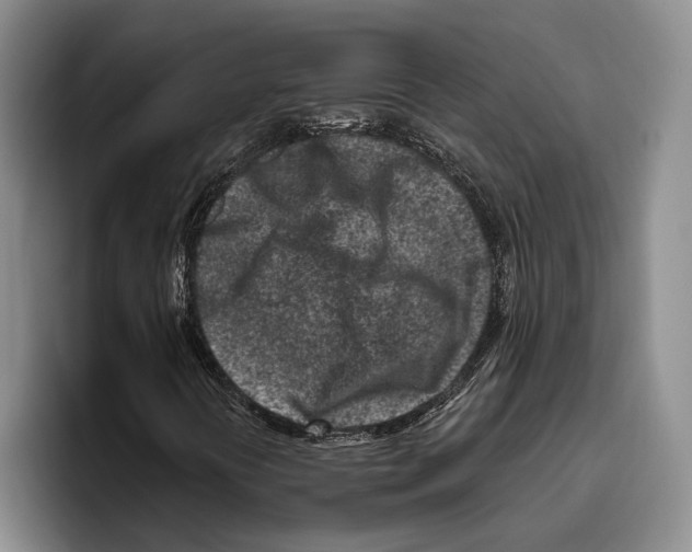 X0000096211394200802151452