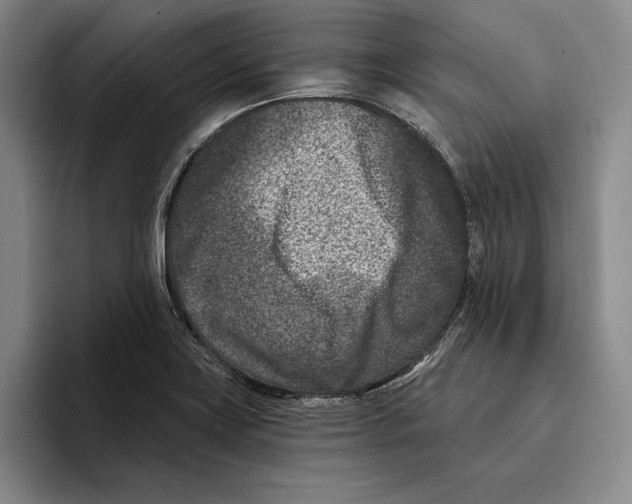 X0000096211419200802151453