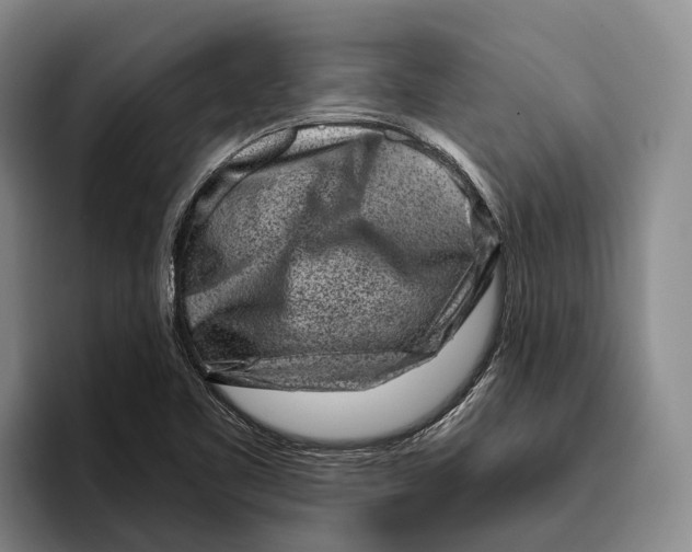 X0000096211461200802151452