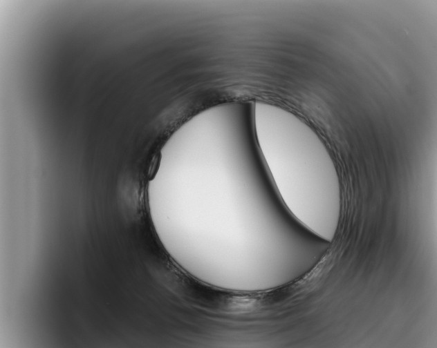 X0000096220176200801181036