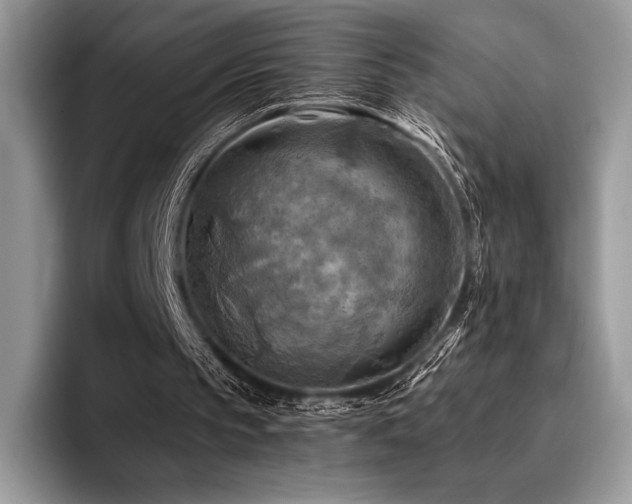 X0000096220145200801181457