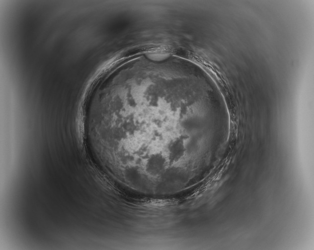 X0000096220149200801181457
